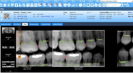 Denticon